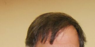 Hazir Mehmeti: Ngushëllime Austri!